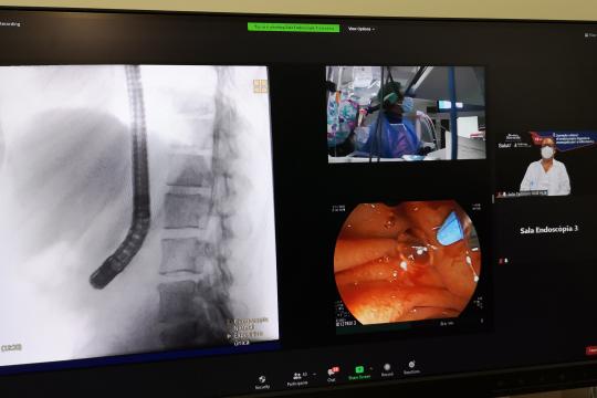 La Unitat d'Audiovisuals ha col·laborat en més de 25 vídeos de tècniques d'endoscòpia avançada